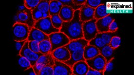 Pancreatic cancer drug