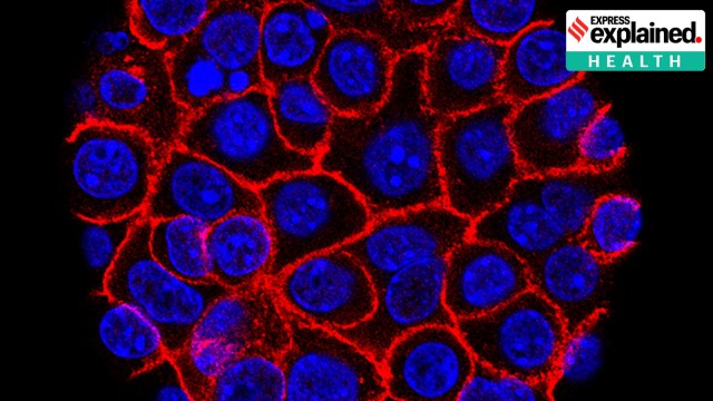 Pancreatic cancer drug
