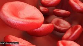 India carries one of the world's largest sickle cell disease burdens, accounting for an estimated 16 per cent of global cases, according to the study.