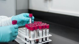 Inspecting officers have been asked to verify compliance with technical standards, assess whether blood collection matches actual demand. (Credit: Pixabay)