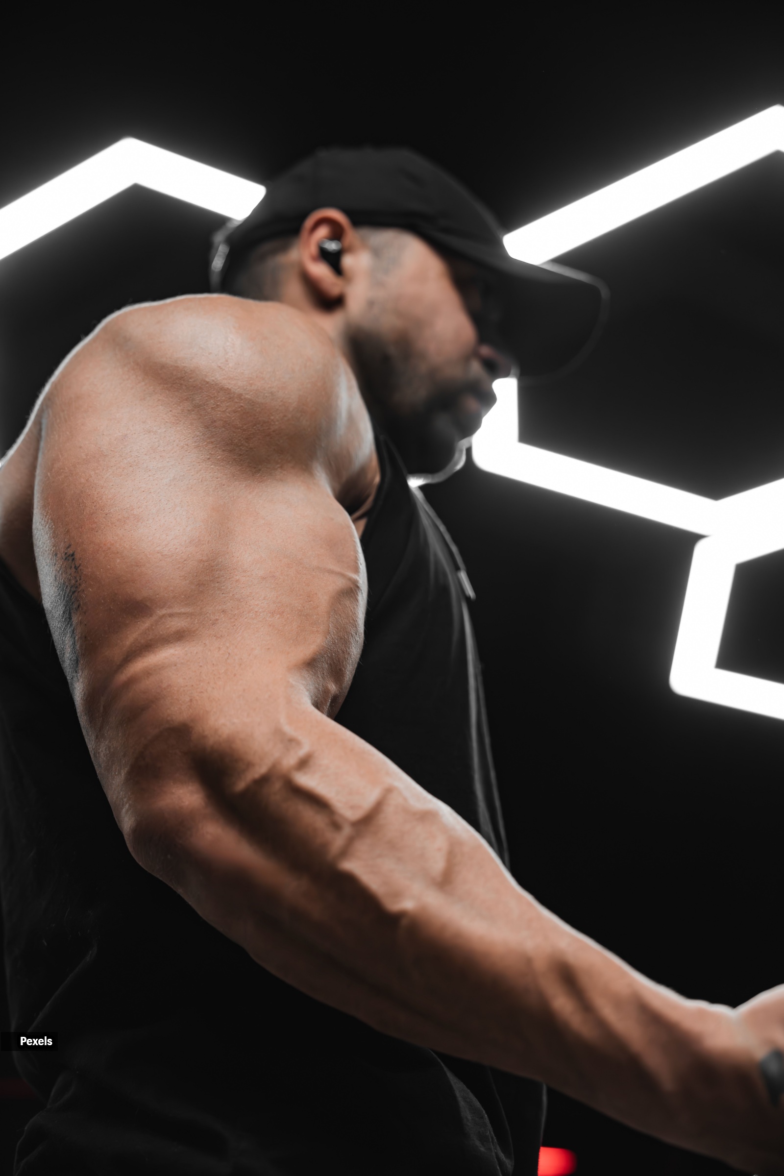veins