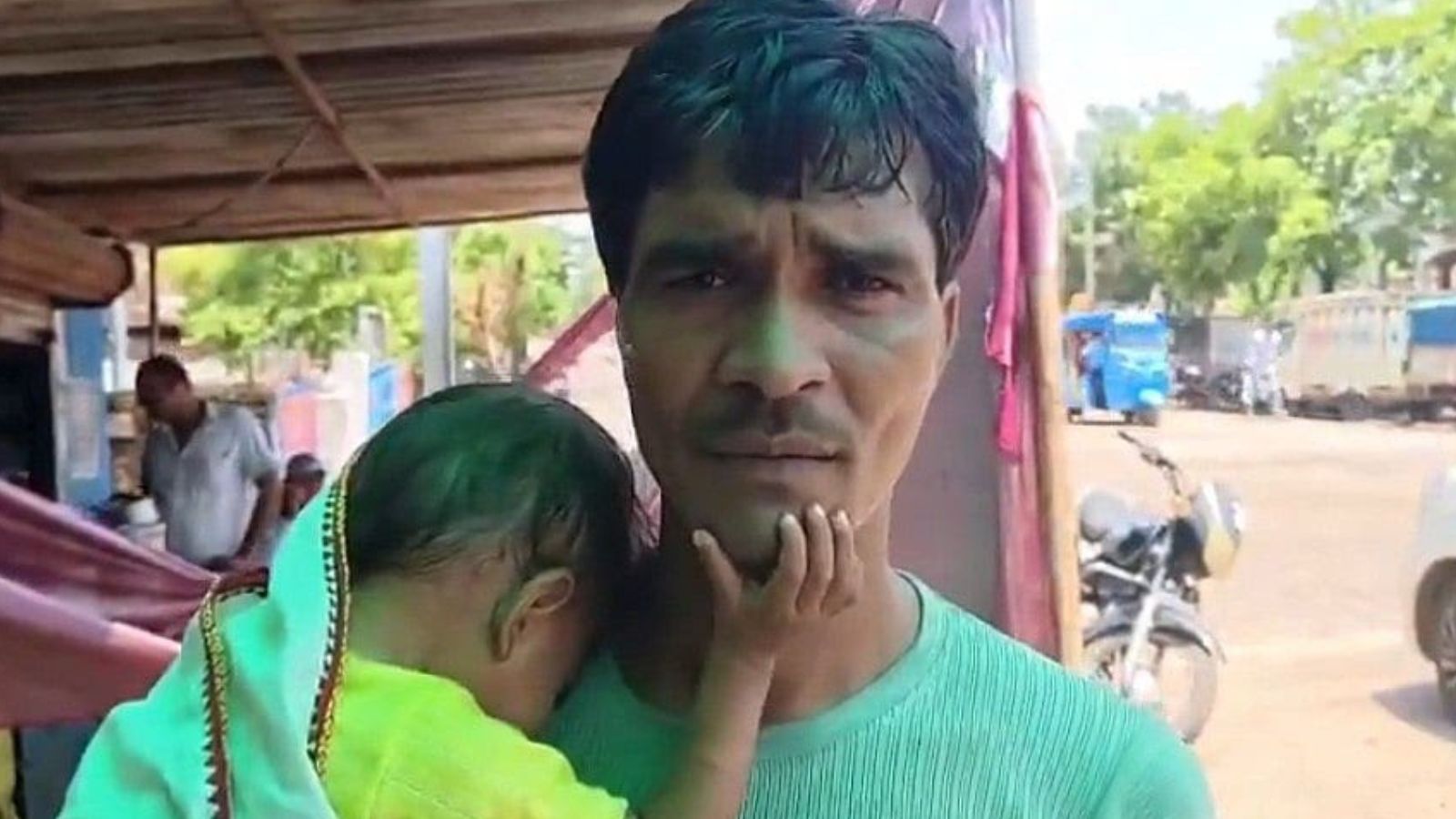 Probe ordered as toddler loses eyesight after treatment in MP hospital