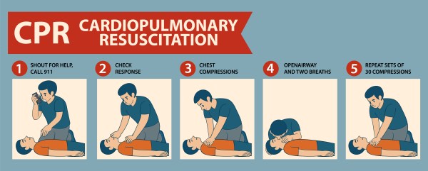 Step-by-Step CPR Instructional Vector Illustration