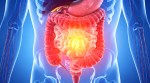 Gut health myths continue to circulate widely on social media