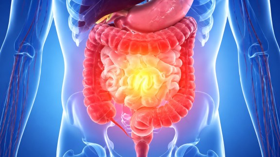 Gut health myths continue to circulate widely on social media