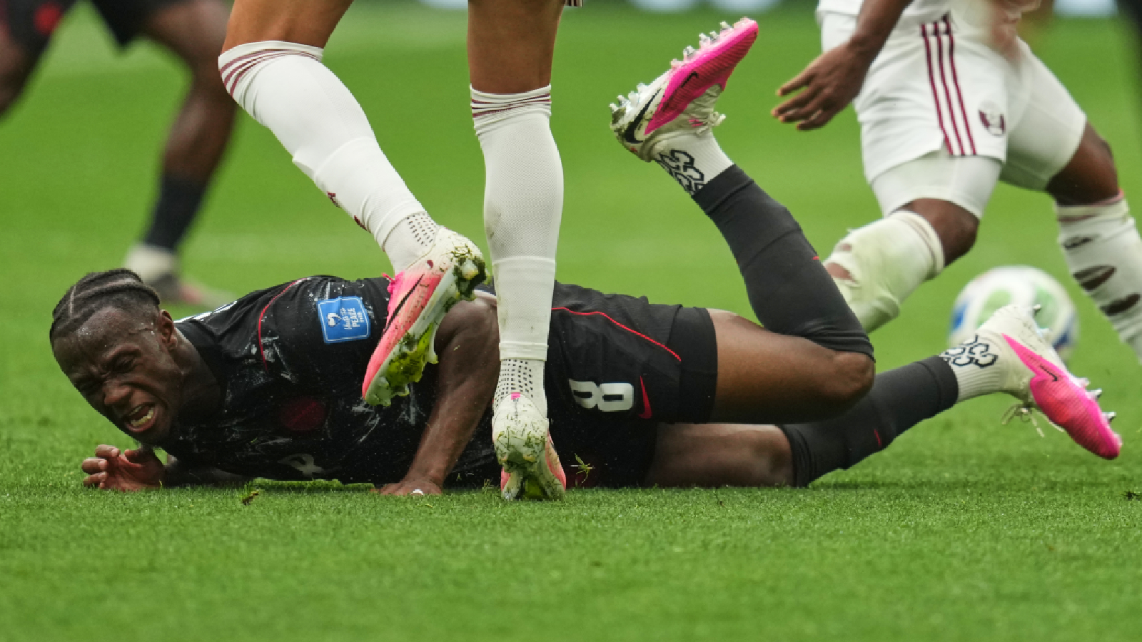Kone has reportedly fractured his fibula and tibia, and is expected to be out of action for at least three months, depending on how surgery and subsequent recovery go. (AP Photo)