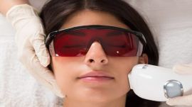 Laser hair removal has become one of India’s most popular cosmetic procedures, but dermatologists are warning of rising cases of burns. (Representative image)