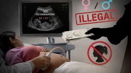 sex-determination test