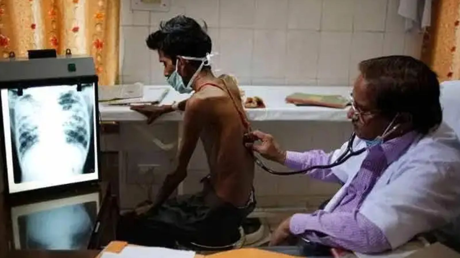 Five questions may be all it takes to identify TB patients who need urgent care