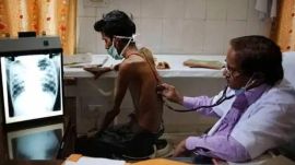 A simple five-question bedside tool can help health workers identify tuberculosis patients at the highest risk of severe illness and death, according to a new study published in BMJ Open, offering an easier alternative to existing triage methods. (File Photo)