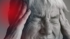 alzheimer's disease