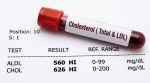 Lipfendra oral pill for lowering LDL cholesterol