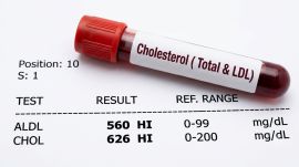 Lipfendra oral pill for lowering LDL cholesterol