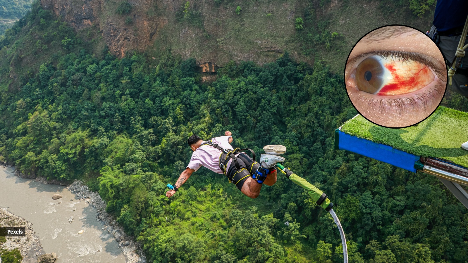Your eyes may turn red after bungee jumping — here’s what is happening