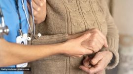 cancer, geriatric assessment,