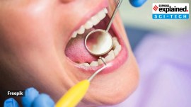 oral cancer treatment, IISc method for oral cancer treatment, oral cancer, Indian Institute of Science, IISc, Indian express explained, explained news, current affairs