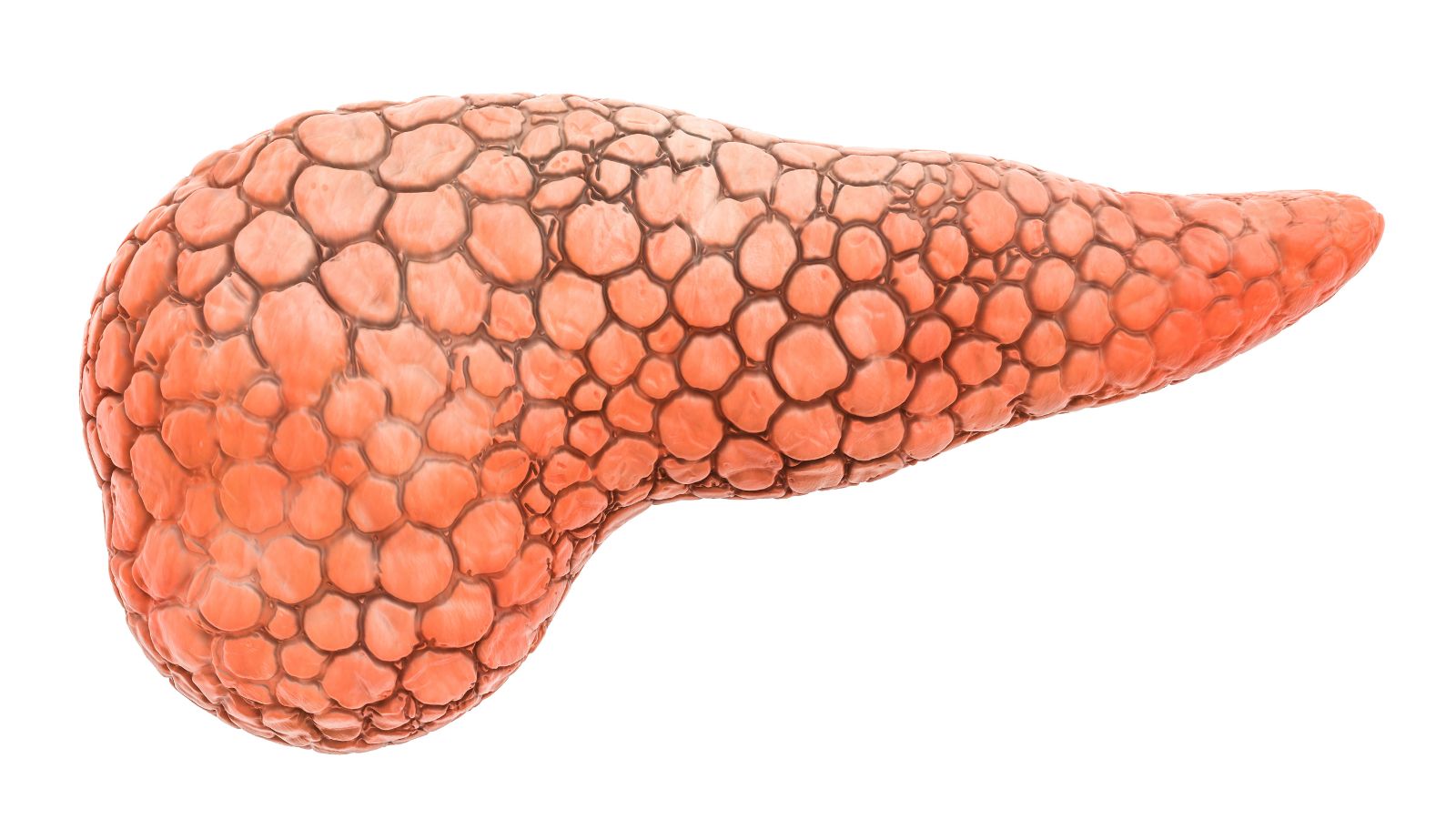 Fatty pancreas may be a warning sign for diabetes, pancreatitis and cancer: Global experts