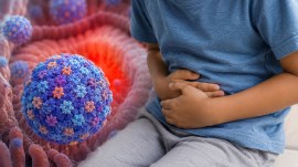 rotavirus