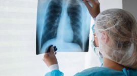 An ICMR study shows drones can transform TB diagnosis in rural India by speeding up sample transport, reducing costs and easing travel burdens for patients in remote areas. (File Photo)