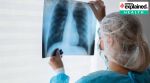 tuberculosis