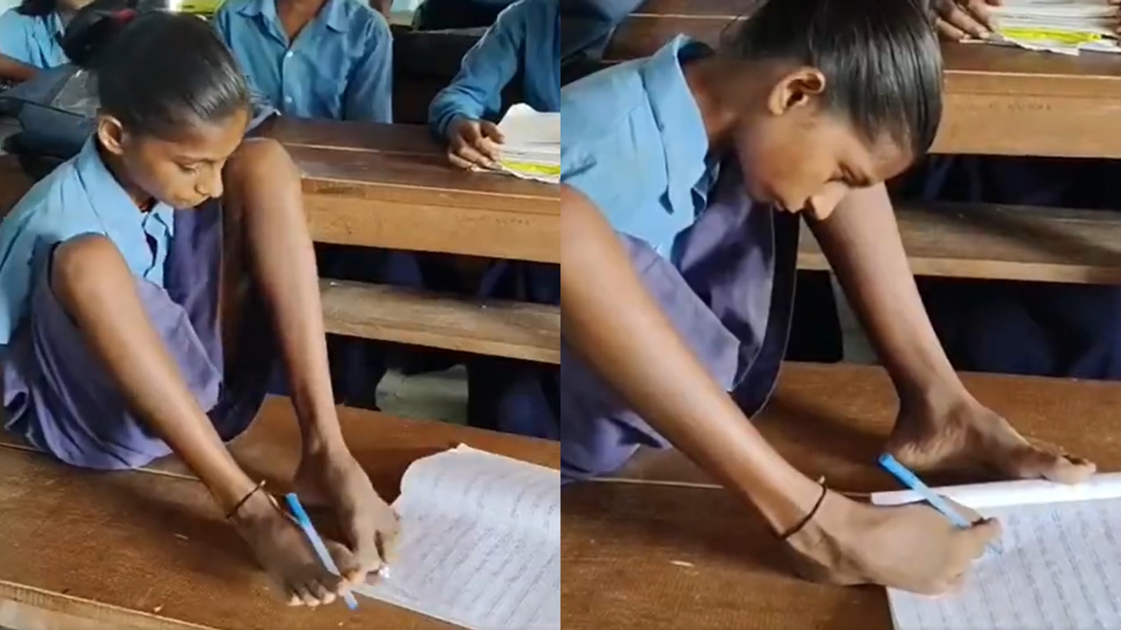 13-year-old Bihar girl uses feet to write, pursue education despite disability