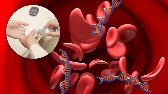 Anaemia and HbA1c blood sugar test results