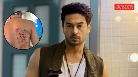 Gaurav Khanna injured on Khatron Ke Khiladi 15