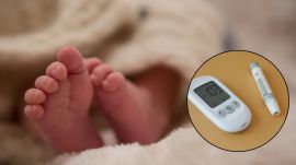 Neonatal diabetes affecting blood sugar and insulin production in babies