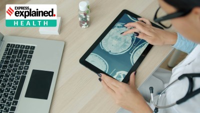 How AI Found a New Pancreatic Cancer Drug