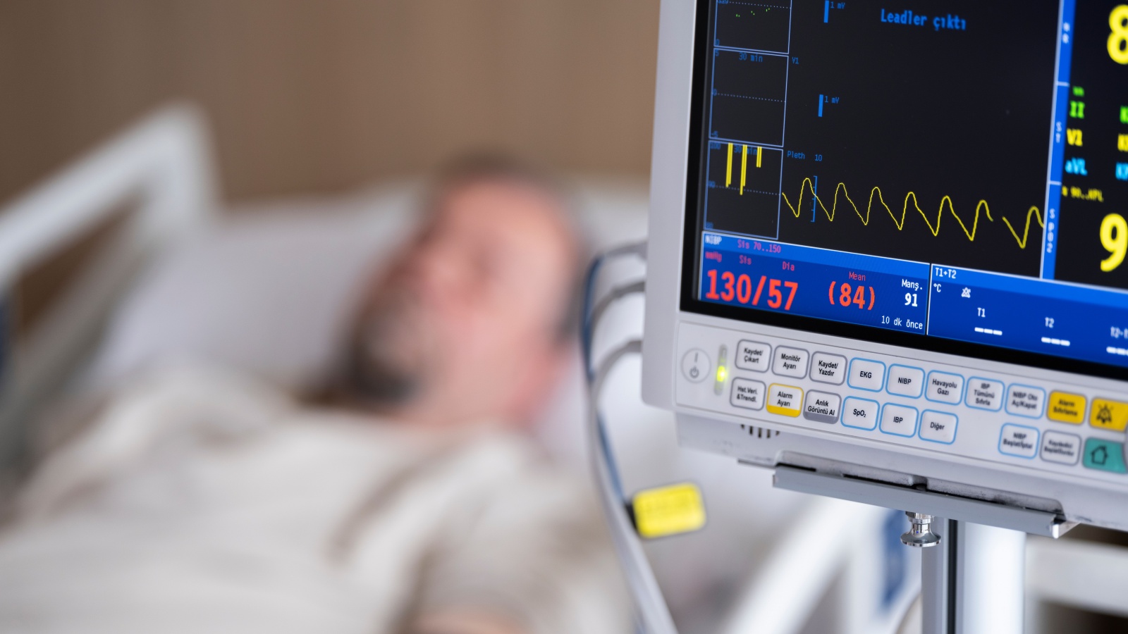 Assam Doctor Collapses and Dies During Gym Workout: The Hidden Dangers of Sudden Cardiac Arrest