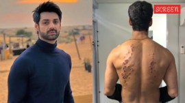 Karan Wahi recalls 'most difficult' pellet gun stunt on KKK15
