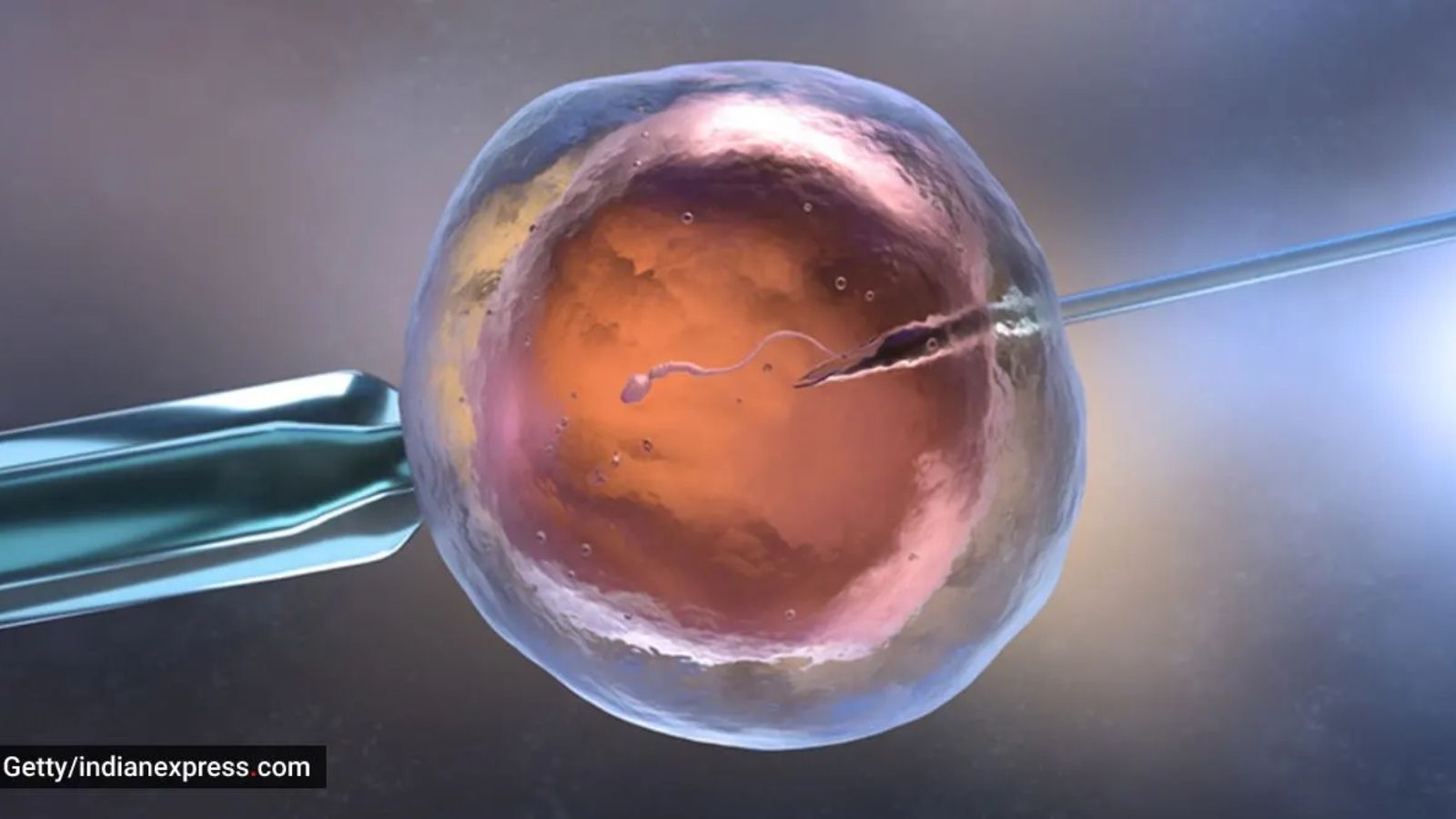 भारत में IVF आयु सीमा: गुजरात के दंपत्तियों ने कानूनी कट-ऑफ को दी चुनौती