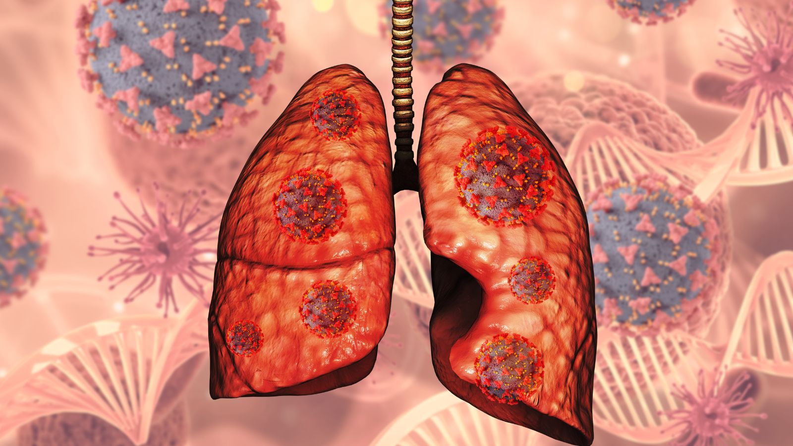 A pulmonologist explains when surgery may be considered for stage zero lung cancer and whether chemotherapy is necessary.