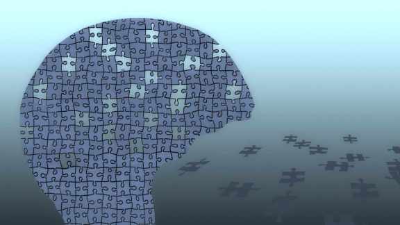 alzheimers
