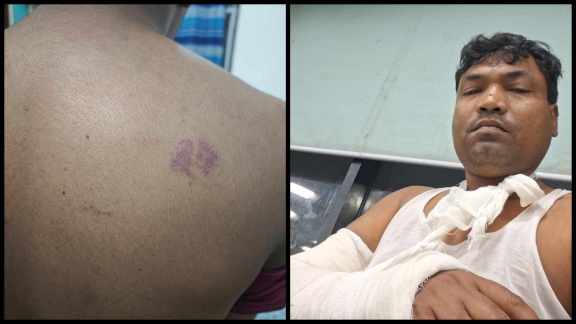 assault in detentions
