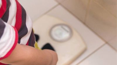 WHO obesity guidelines for children