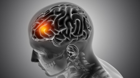 cortisol