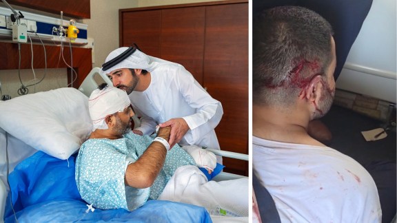 flydubai incident, indian pilot, axe, Hamam al-Hammami ,